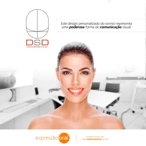 Digital Smile Design