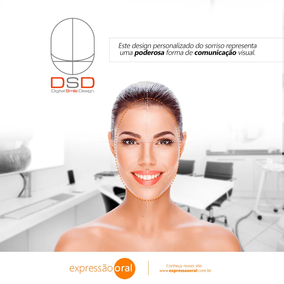 DSD – Digital Smile Design