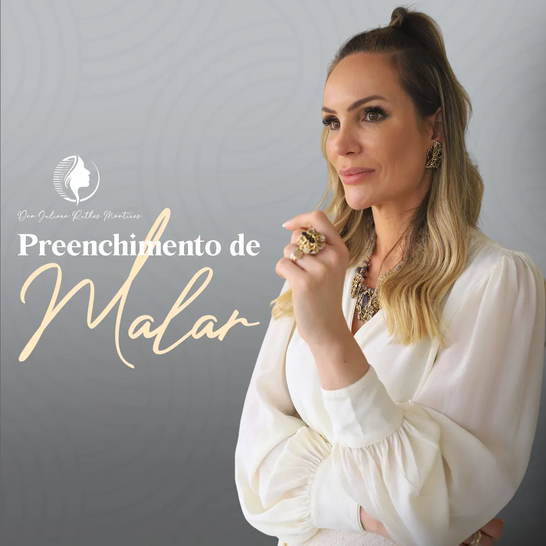O que é preenchimento de malar?