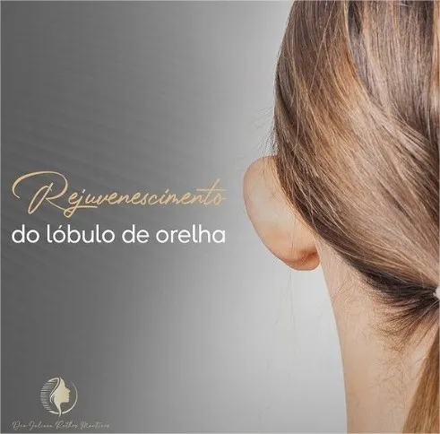 Como rejuvenescer o lóbulo da orelha?
