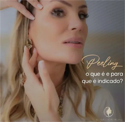 O que é peeling e para que serve?
