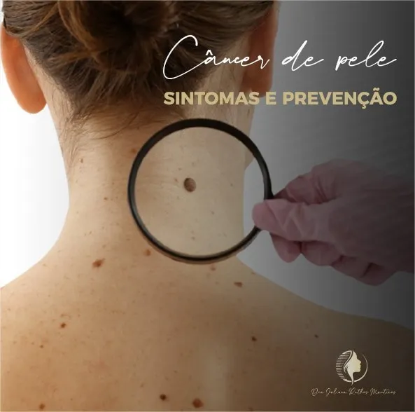 Quais são os primeiros sinais de câncer de pele?
