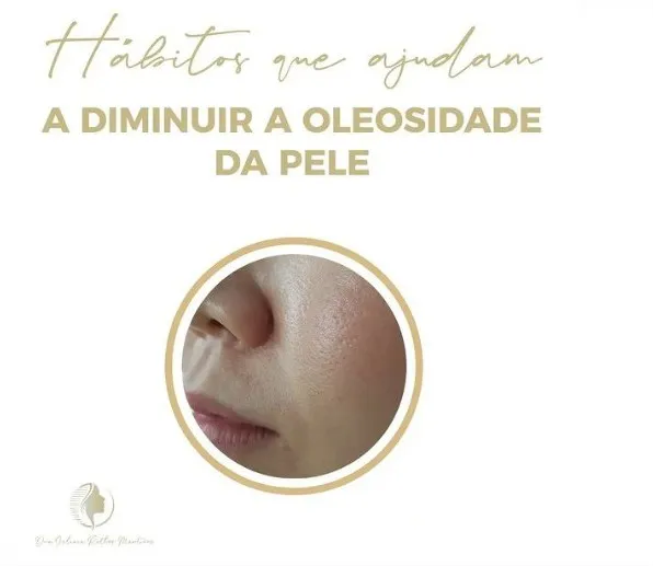 O que diminui a oleosidade da pele?