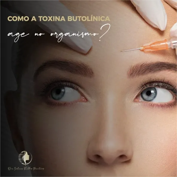 O que é toxina botulínica e como ela age?